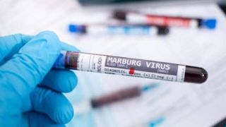 هشدار کشورهای عربی به مسافران درباره ویروس «ماربورگ»