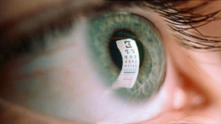 آيا عمل ليزيک چشم مفيد است؟