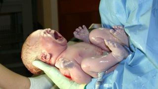 نوزادانی که برای به دنیا آمدن عجله دارند