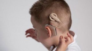 حذف صف انتظار کاشت حلزون شنوایی / کاشت رایگان برای حدود ۲۰۰۰ کودک تاکنون