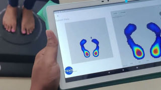 تشخیص نارسایی قلبی توسط هوش مصنوعی با اسکن پا