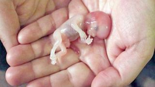 پرونده غم انگیز سقط جنین در انگلستان پرونده غم انگیز سقط جنین در انگلستان