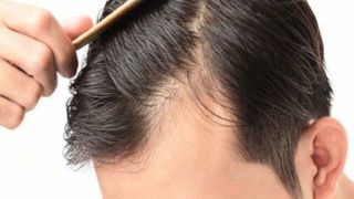 چرا موها میریزند و ریزش چند تار مو در روز طبیعی است؟ چرا موها میریزند و ریزش چند تار مو در روز طبیعی است؟