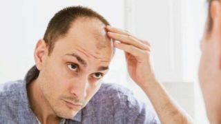 چند باور نادرست درباره ریزش مو چند باور نادرست درباره ریزش مو