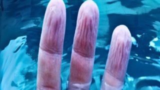 نکات شگفت‌انگیزی که در مورد چین و چروک پوست خیس‌خورده در آب نمی‌دانستید