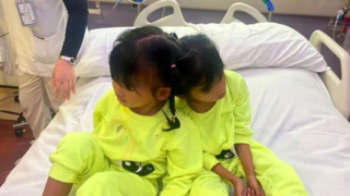 عربستان دوقلوهای چسبیده فیلیپینی را از هم جدا میکند عربستان دوقلوهای چسبیده فیلیپینی را از هم جدا میکند