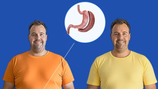 بیمارانی که با عمل اسلیو پلاس دکتر ایرانمنش دوباره زندگی کردند؛ روایت موفقیتها بیمارانی که با عمل اسلیو پلاس دکتر ایرانمنش دوباره زندگی کردند؛ روایت موفقیتها