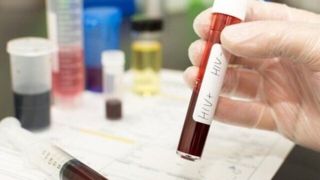 شناسایی ۱۹۱ مبتلا به HIV در منطقه کاشان شناسایی ۱۹۱ مبتلا به HIV در منطقه کاشان
