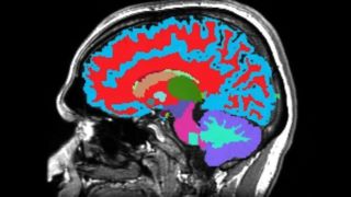 ساخت ابزار اندازهگیری سرعت پیری و پیشبینی زوال عقل ساخت ابزار اندازهگیری سرعت پیری و پیشبینی زوال عقل