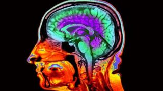 اسکن مغز، سرعت واقعی پیر شدن شما را فاش میکند اسکن مغز، سرعت واقعی پیر شدن شما را فاش میکند
