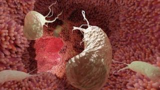 درمان ساده‌ای که می‌تواند از ۷۵ درصد سرطان‌های معده جلوگیری کند  