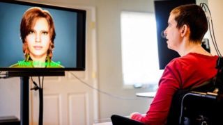 بازگشت گفتار بیمار فلج پس از ۱۸ سال با ایمپلنت مغزی