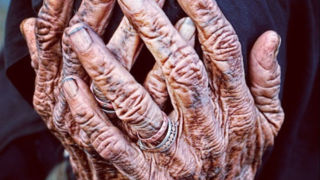 چرا پوست ما با افزایش سن چروک می‌شود؟