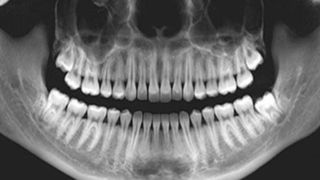 آموزش خواندن عکس دندان آموزش خواندن عکس دندان