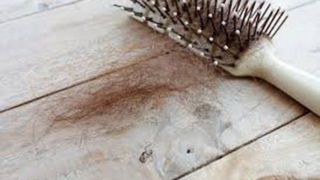 چه زمانی ریزش مو طبیعی نیست؟ چه زمانی ریزش مو طبیعی نیست؟