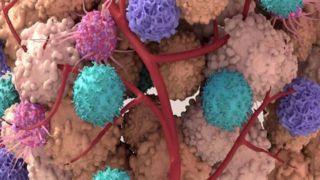 پژوهشگران انگلیسی، سیستم هشدار سرطان ساختند!