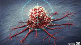 آیا سرطان مهار شدنی است؟