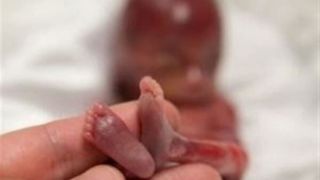 دلایل اصلی سقطهای عمدی/حدود ۳۰ درصد بارداریها خودبهخود پایان مییابد دلایل اصلی سقطهای عمدی/حدود ۳۰ درصد بارداریها خودبهخود پایان مییابد