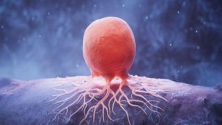 مبارزه با سرطان از طریق کاهش چربی بدن