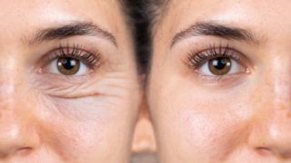 ۱۰ روش موثر جوان سازی پوست در یک جلسه [بدون جراحی]