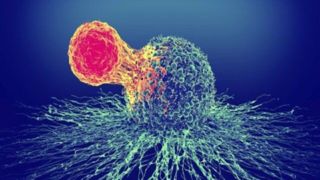 درمان سرطان بدون عوارض جانبی با روشی جدید  