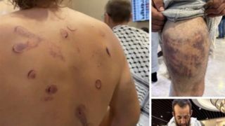دیگر نمی توان «نکبت» صهیونیسم را لاپوشانی کرد