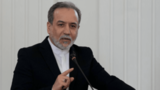 عراقچی: وضعیت کشور جنگی است و با صلح فاصله داریم